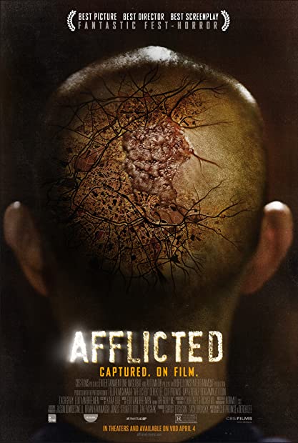 Afflicted 2013 1080p BluRay H264 AC3 Will1869